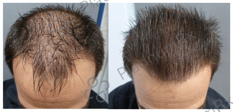 Tinfal Plus Solution 60ml