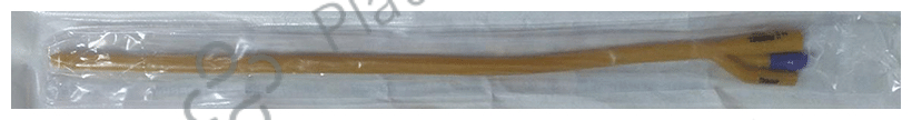 Ribbel 3 Way Foley Balloon Catheter 18FR