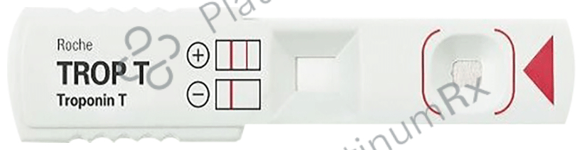 Trop T Sensitive Test Kit