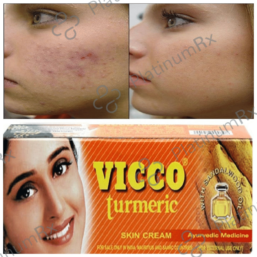 Vicco Turmeric Skin Cream 15 gm