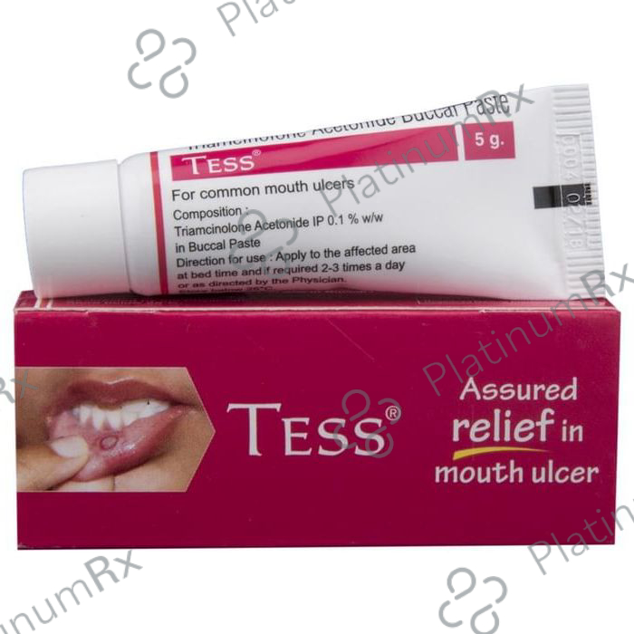 Tess 0.1% Oral Paste 5gm