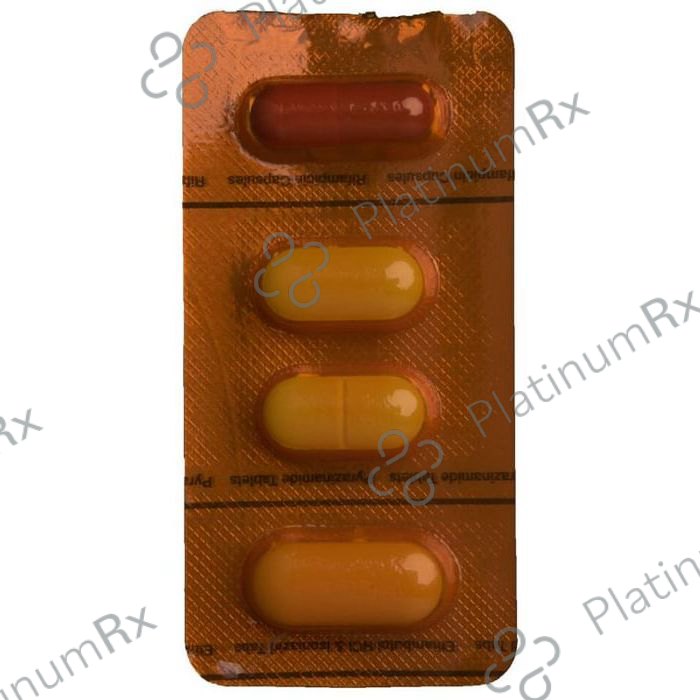 Akt 4 Kit