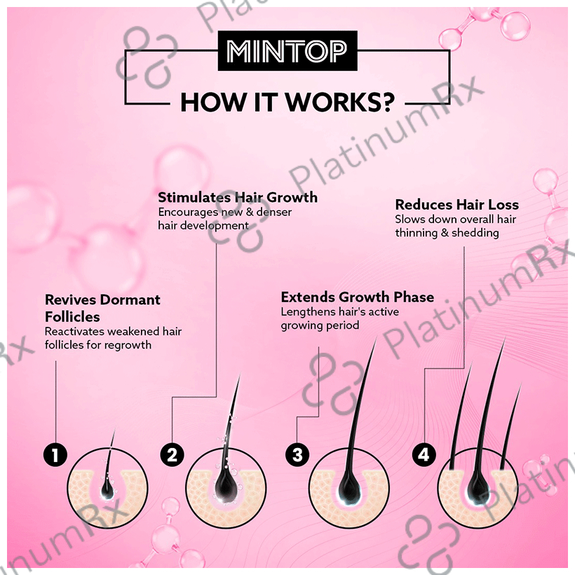 Mintop Forte 2% Hair Restore Formula Solution 60ml