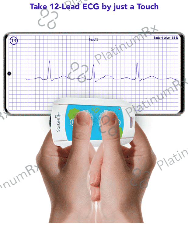 Agatsa SanketLife 2.0 Portable ECG Device – 12 lead ECG Machine for 1/6/12 Lead ECG, HRV by Touch