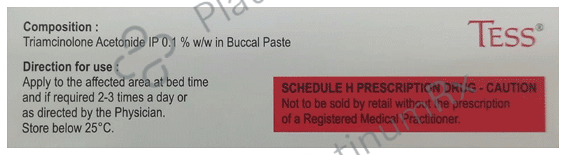 Tess 0.1% Oral Paste 5gm
