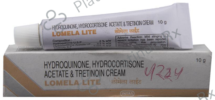 Lomela Lite Cream